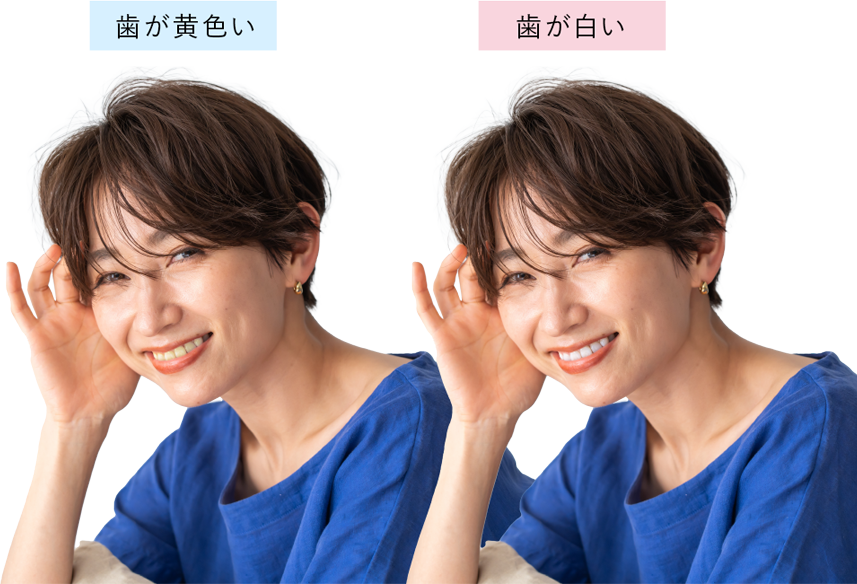 歯が黄色い 歯が白い 比較